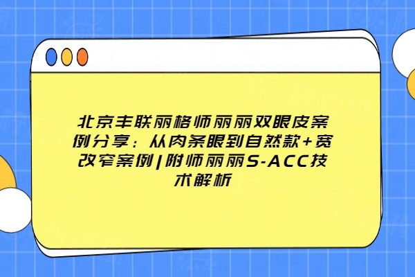 北京豐聯(lián)麗格師麗麗雙眼皮實(shí)例