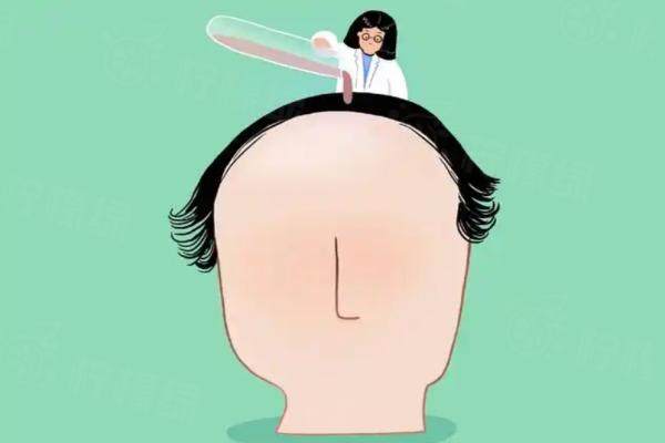 cgf治療脫發(fā)一療程打幾針