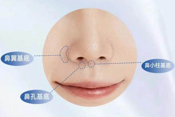 鄭州胡志成隆鼻怎么樣