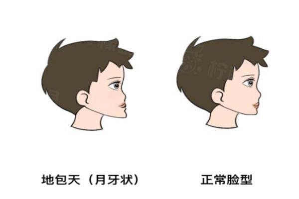 廣州正頜手術(shù)做得好的醫(yī)生排名