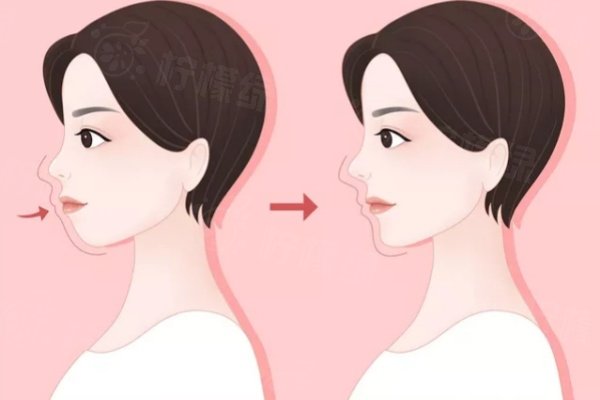 成都正頜手術醫(yī)生推薦