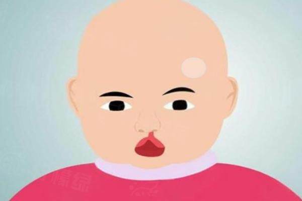 杭州維多利亞醫(yī)院做唇腭裂修復(fù)口碑