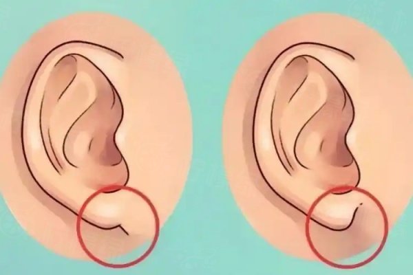 深圳和睦家耳再造費(fèi)用多少錢(qián)