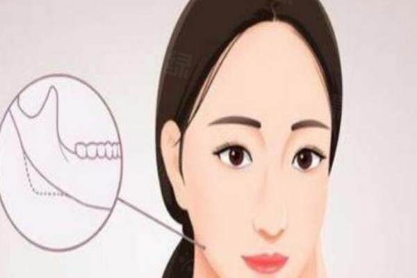 何照華磨骨多少錢(qián)