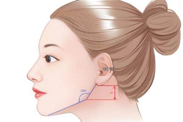 何照華頜面整形實(shí)例