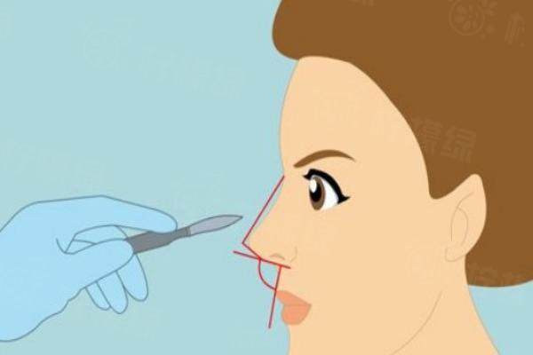 北京畫(huà)美醫(yī)療美容醫(yī)院地址在哪里