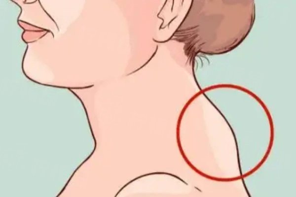 深圳南雅抽脂醫(yī)院地址