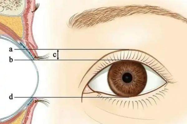 張冰潔醫(yī)生做上瞼提肌矯正怎么樣