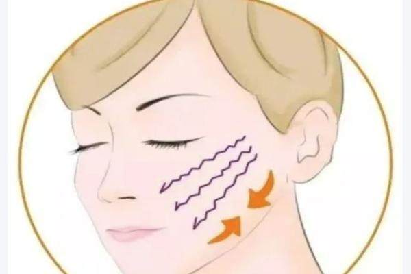 曹正東醫(yī)生做線雕多少錢