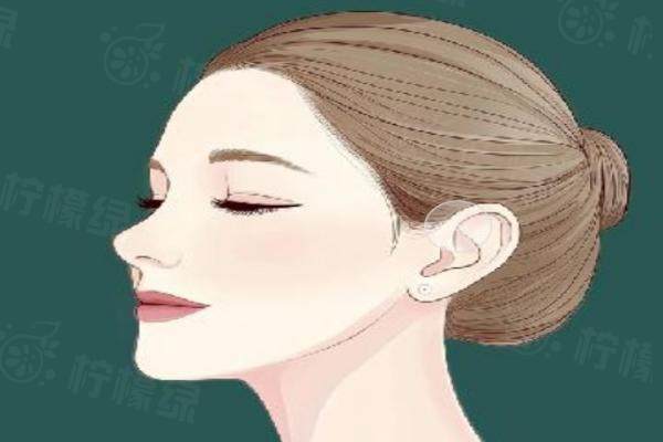 張冰潔醫(yī)生做上瞼提肌矯正口碑好嗎