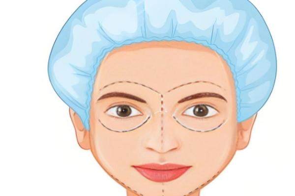 章宏偉醫(yī)生做全臉脂肪填充實例