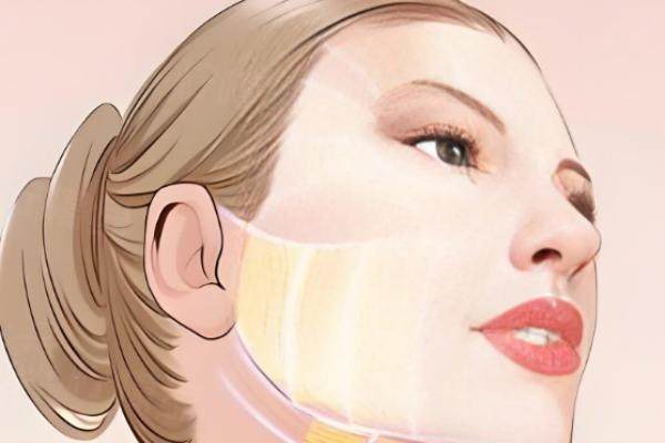 南寧華美整形醫(yī)院做拉皮多少錢