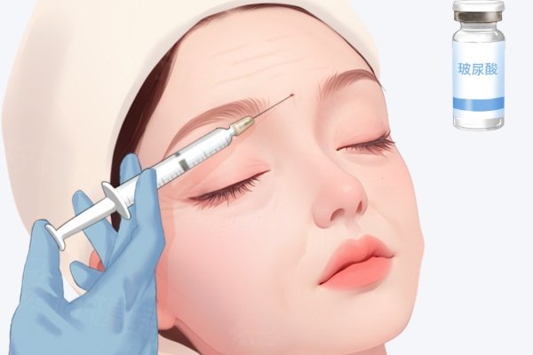 面部輕薄針多少錢一針