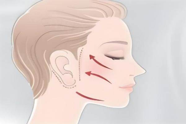 北京奧爾貝德醫(yī)院做小拉皮手術(shù)好嗎