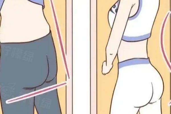 自體脂肪豐臀一年后注意事項(xiàng)