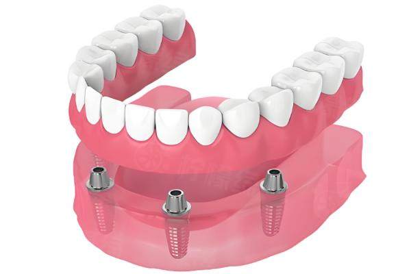 呼和浩特天牙口腔吳澤宇口腔醫(yī)生個人簡介