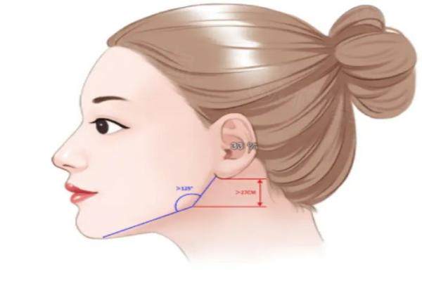 杭州時光醫(yī)療美容醫(yī)院做輪廓固定醫(yī)生