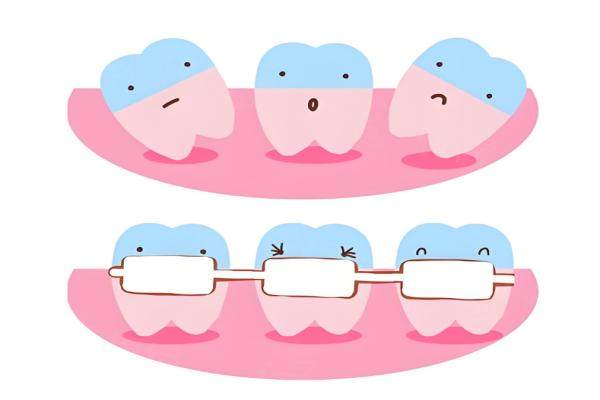 鄭州德韓口腔整牙價格