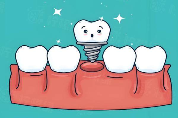 呼和浩特天牙口腔吳澤宇醫(yī)生口碑如何