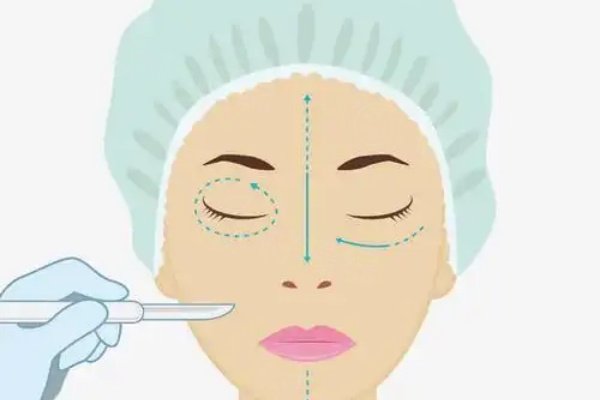 愛思特張姣姣修復(fù)技術(shù)怎么樣