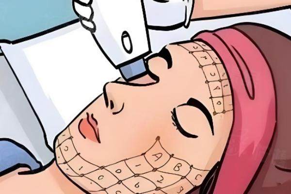 北京曹其帥醫(yī)生做熱瑪吉價(jià)格表