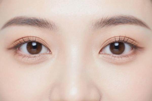 西安孫峰雙眼皮手術好不好