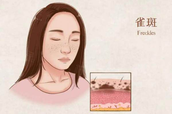 貴陽激光祛斑醫(yī)院排名前十