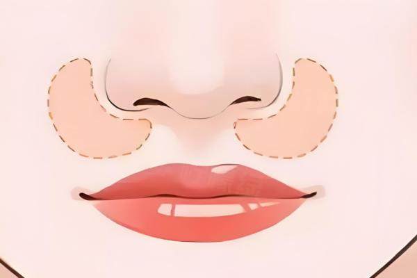 福州朱剛強(qiáng)醫(yī)生口碑如何