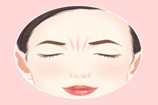 李廣學(xué)真皮填充川字紋靠譜嗎