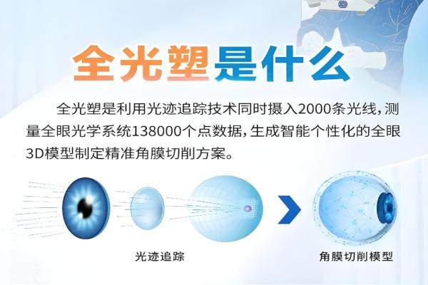 西安四院眼科近視手術(shù)醫(yī)生排名介紹