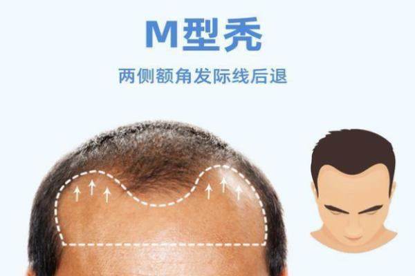 上海發(fā)際線調(diào)整醫(yī)院