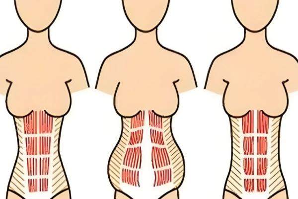 國內(nèi)肚皮拉皮手術(shù)醫(yī)院哪家好