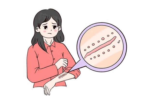 武漢正璞疤痕醫(yī)院地址