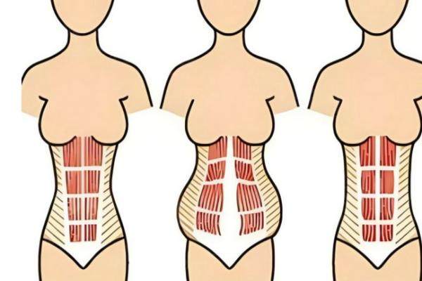 韓國 365mc 醫(yī)院的吸脂技術(shù)怎么樣