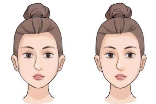 南寧磨骨手術(shù)多少錢