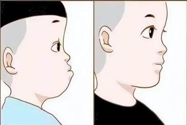 正頜手術(shù)廣州哪家醫(yī)院好