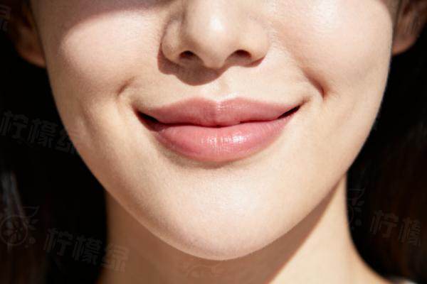 韓國李炫直嘴角上揚(yáng)術(shù)實例