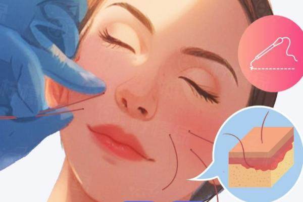 常州美貝爾醫(yī)院做線雕醫(yī)生名單