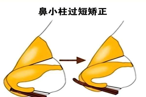 上海隆鼻醫(yī)生排名前十