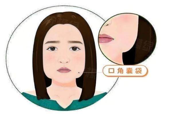 口角囊袋手術(shù)醫(yī)院排名前十