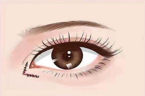 呂方中醫(yī)生在哪家醫(yī)院