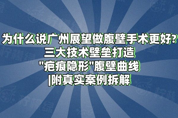 廣州展望做腹壁手術(shù)更好
