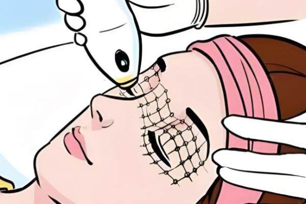 45 歲女性適合做的整形項目有哪些