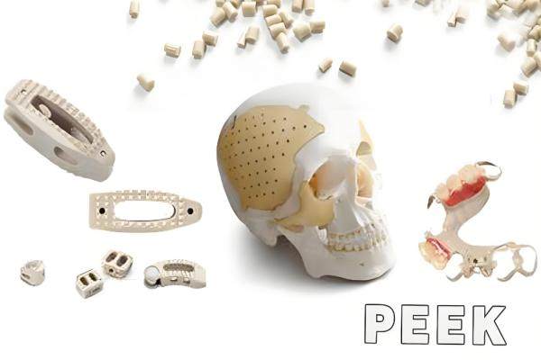 peek材料移植修復(fù)下頜角多少錢(qián)