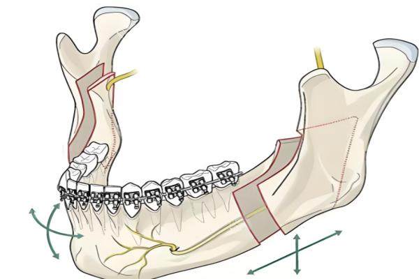 廣州削骨出名的醫(yī)生排名前十