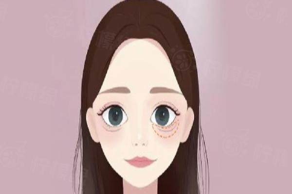 南京臥蠶手術(shù)醫(yī)院哪家好