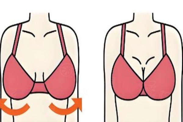 大嘉醫(yī)療 3s 豐胸成果怎么樣