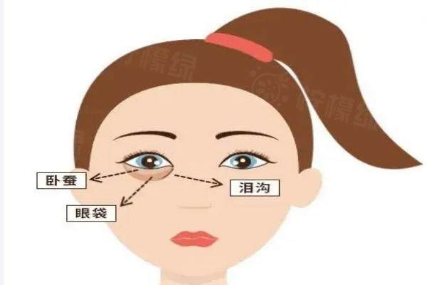 北京淚溝填充哪個醫(yī)生好