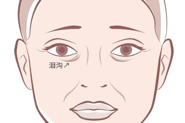 北京淚溝填充醫(yī)生推薦