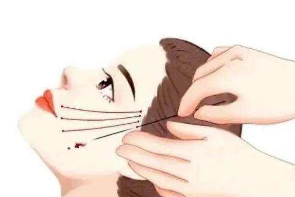 筋膜提升多久<span style=